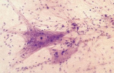 Histological image of neuron cell body