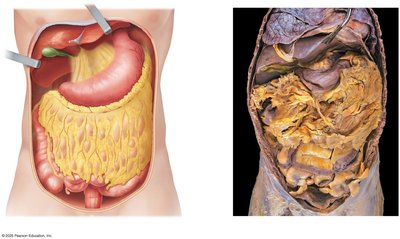 Abdominal cavity with greater omentum