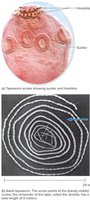 Taenia solium scolex and adult tapeworm