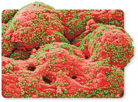 Cryptosporidium attached to intestinal epithelium