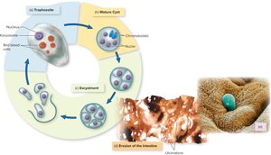 Entamoeba histolytica life cycle and intestinal erosion