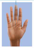 Photo of flexure lines on the palm of a hand