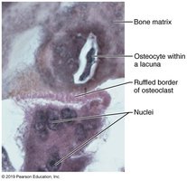 Osteoclast and bone matrix