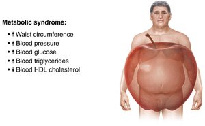 Metabolic syndrome