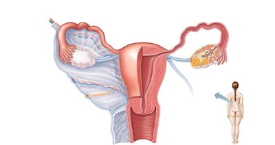Internal reproductive organs of a female, posterior view