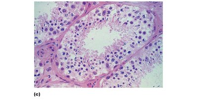 Histology of seminiferous tubules