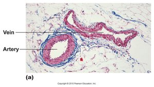 Histological section showing artery and vein