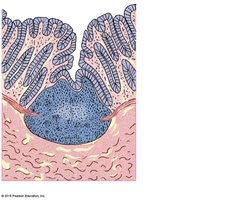 Aggregated lymphoid nodules in the intestine