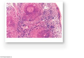 Histology of the spleen showing red and white pulp