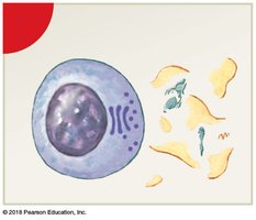 Lysis of abnormal cell by NK cell