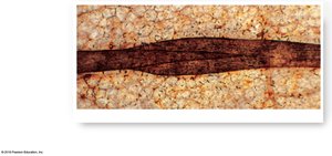 Microscopic view of lymphatic vessel valve