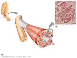 Diagram showing muscle hypertrophy