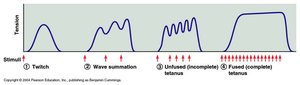 Graph showing incomplete tetanus