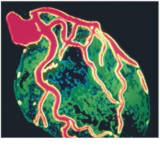 Normal coronary circulation