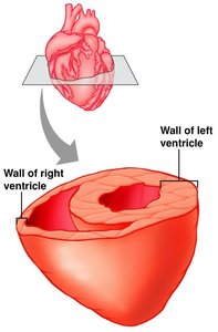 Cross-section showing wall thickness of left and right ventricles