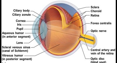 Cataract in the lens