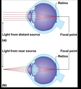 Focusing light on the retina