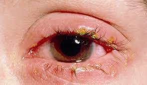 Extrinsic eye muscles and accessory structures of the eye