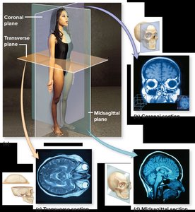 Anatomical position