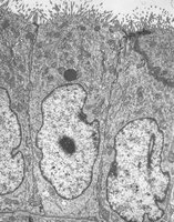 Transmission electron micrograph of a eukaryotic cell