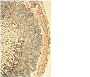 Aggregated lymphoid nodules (Peyer's patch) in the intestinal wall
