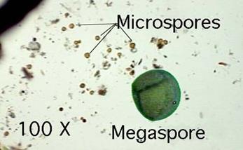 Microspores and megaspore under microscope