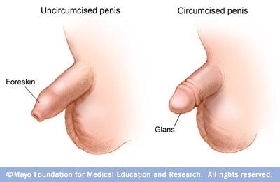 Uncircumcised and circumcised penis