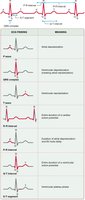 ECG intervals and segments