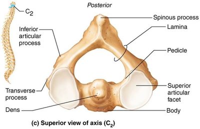 Superior view of axis (C2) with labeled features
