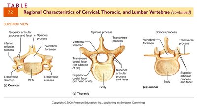 Right lateral view of lumbar vertebra with labeled features