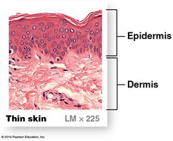 Histological section of thin skin showing epidermis and dermis