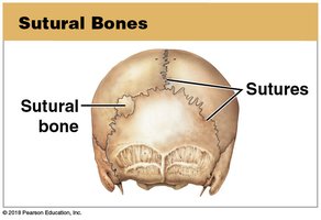 Sutural bones in the skull