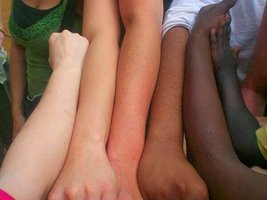 Variation in human skin color