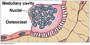 Osteoclast in medullary cavity