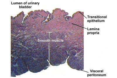 Histology of the urinary bladder