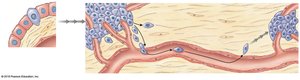 Development and metastasis of cancer