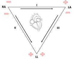 Einthoven's triangle diagram showing limb lead placement and polarity