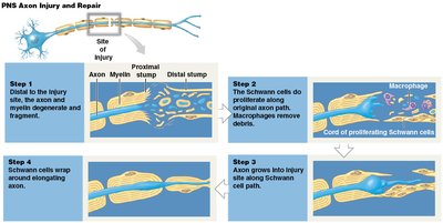 PNS axon injury and repair process
