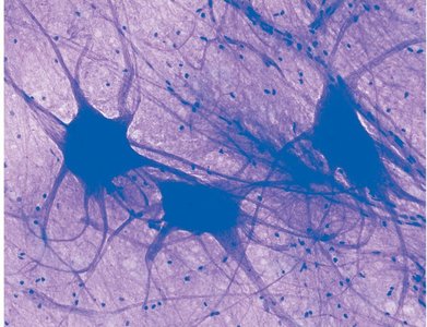 Micrograph of nervous tissue showing neurons and neuroglia