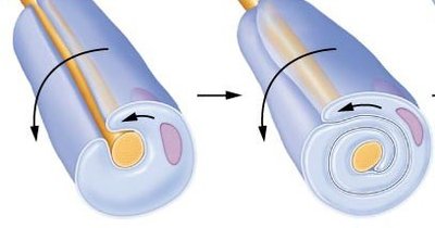 Diagram of myelination by Schwann cells in the PNS