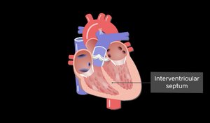Diagram showing the interventricular septum