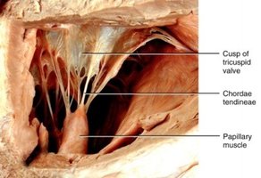 Anatomical image showing chordae tendineae and papillary muscle