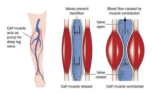 Diagram showing venous valves and blood flow in the leg veins