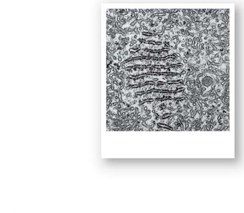 TEM of rough ER and ribosomes
