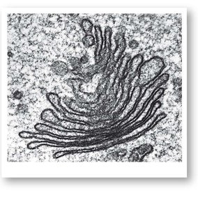 TEM of Golgi apparatus