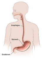 Diagram showing the esophagus, stomach, and duodenum in the human body