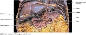 Gross anatomy of the stomach, cadaver photo