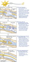 Regeneration of a nerve fiber in a peripheral nerve