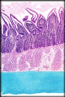 Histological section of GI tract wall