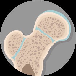 Epiphyseal line in a long bone